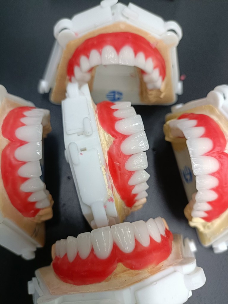 sản phẩm răng giả tháo lắp